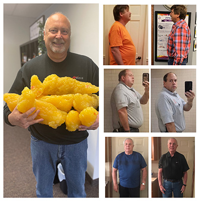 Weight Loss Battle Creek MI Before and After