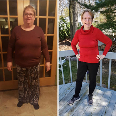 Weight Loss Battle Creek MI Before and After