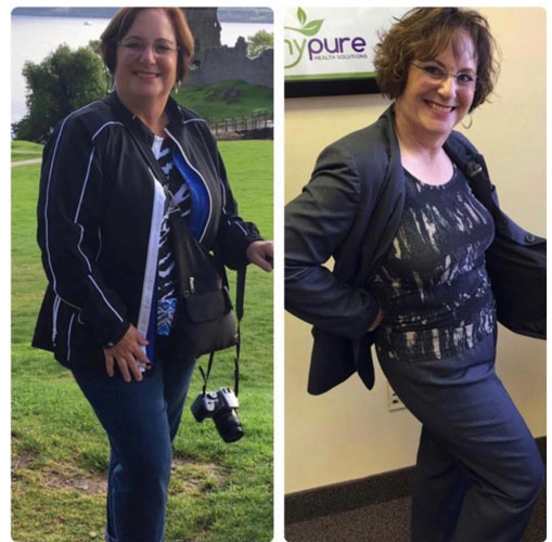 Weight Loss Battle Creek MI Before and After