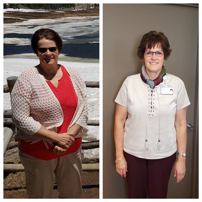 Weight Loss Battle Creek MI Before and After