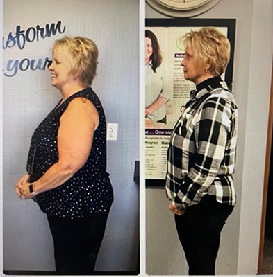 Weight Loss Battle Creek MI Before and After