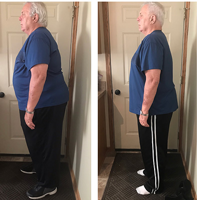 Weight Loss Battle Creek MI Before and After