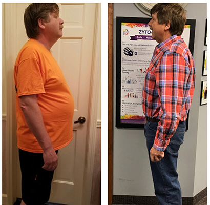 Weight Loss Battle Creek MI Before and After