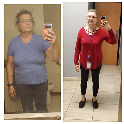 Weight Loss Battle Creek MI Before and After