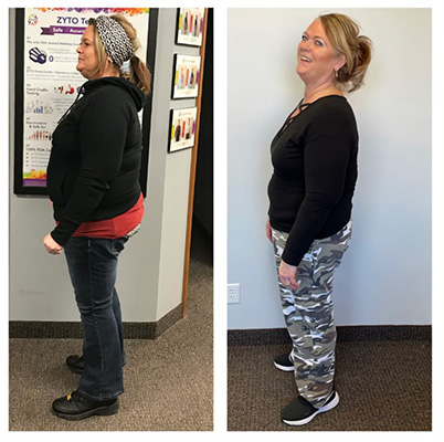 Weight Loss Battle Creek MI Before and After