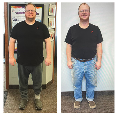 Weight Loss Battle Creek MI Before and After